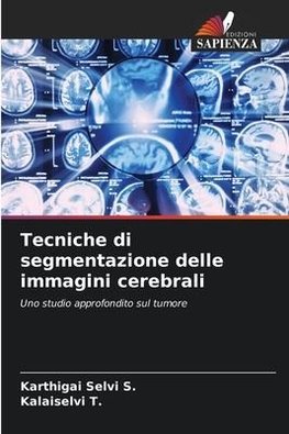 Tecniche di segmentazione delle immagini cerebrali