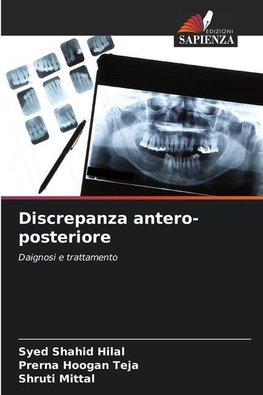 Discrepanza antero-posteriore