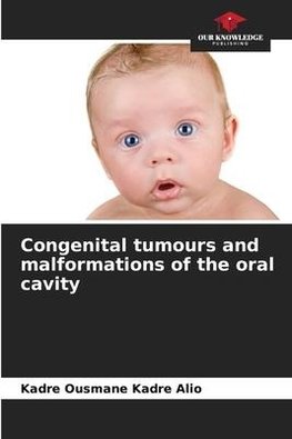 Congenital tumours and malformations of the oral cavity