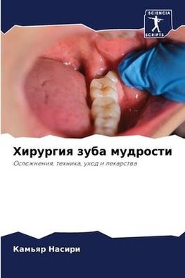 Hirurgiq zuba mudrosti