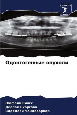 Odontogennye opuholi