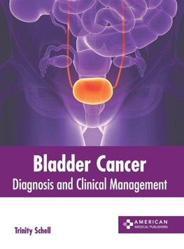Bladder Cancer