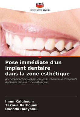 Pose immédiate d'un implant dentaire dans la zone esthétique