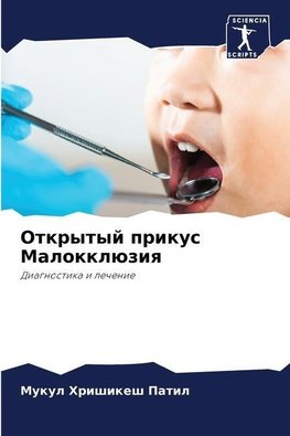 Otkrytyj prikus Malokklüziq