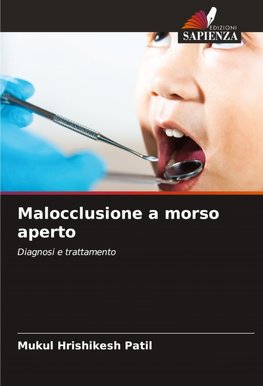 Malocclusione a morso aperto