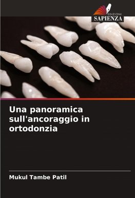 Una panoramica sull'ancoraggio in ortodonzia