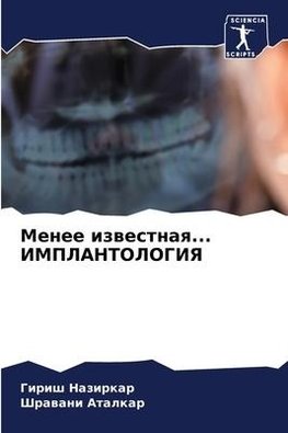 Menee izwestnaq... IMPLANTOLOGIYa