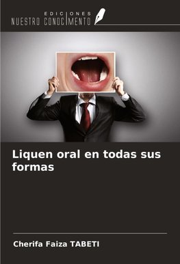 Liquen oral en todas sus formas