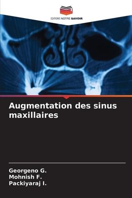 Augmentation des sinus maxillaires