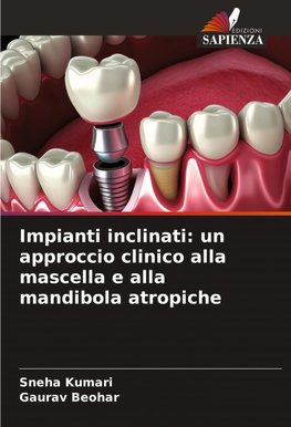 Impianti inclinati: un approccio clinico alla mascella e alla mandibola atropiche