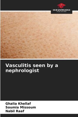 Vasculitis seen by a nephrologist