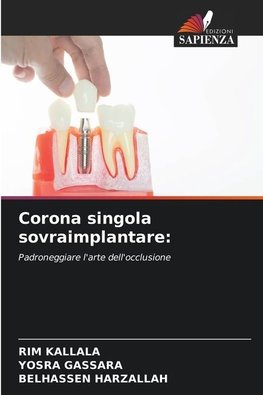 Corona singola sovraimplantare: