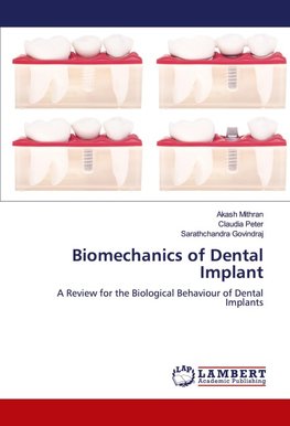 Biomechanics of Dental Implant