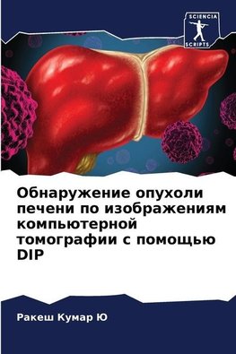 Obnaruzhenie opuholi pecheni po izobrazheniqm komp'üternoj tomografii s pomosch'ü DIP