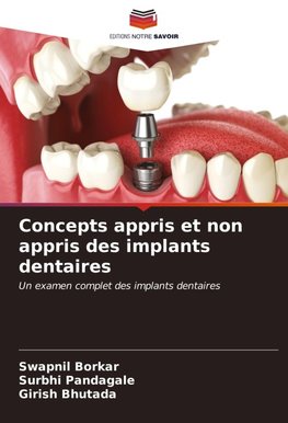 Concepts appris et non appris des implants dentaires