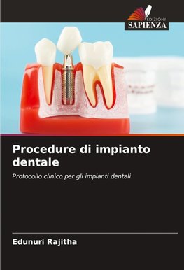 Procedure di impianto dentale