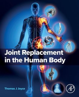 Joint Replacement in the Human Body