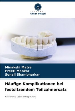 Häufige Komplikationen bei festsitzendem Teilzahnersatz