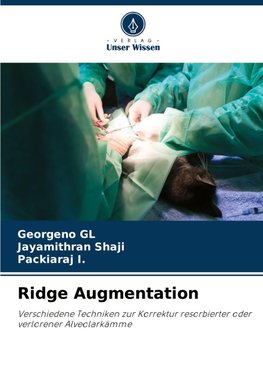 Ridge Augmentation