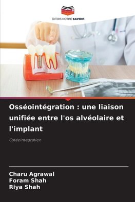 Osséointégration : une liaison unifiée entre l'os alvéolaire et l'implant