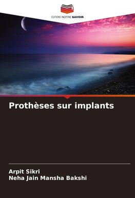 Prothèses sur implants