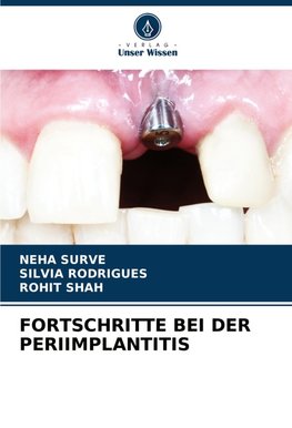 FORTSCHRITTE BEI DER PERIIMPLANTITIS