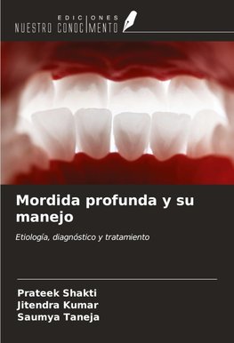 Mordida profunda y su manejo