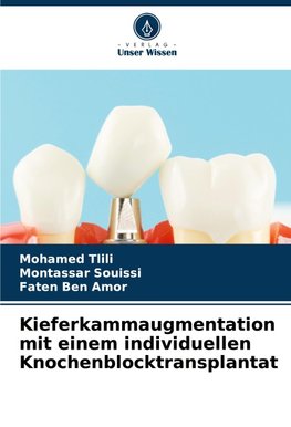 Kieferkammaugmentation mit einem individuellen Knochenblocktransplantat