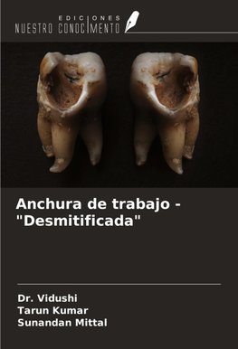 Anchura de trabajo - "Desmitificada"