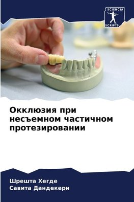 Okklüziq pri nes#emnom chastichnom protezirowanii