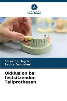 Okklusion bei festsitzenden Teilprothesen