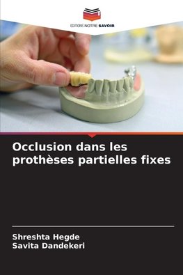 Occlusion dans les prothèses partielles fixes