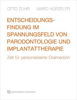 Entscheidungsfindung im Spannungsfeld von Parodontologie und Implantattherapie