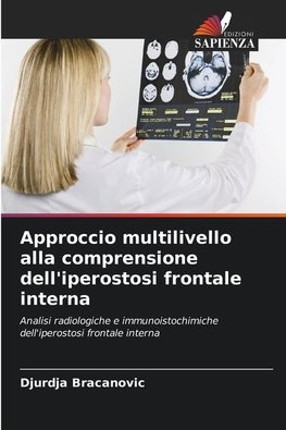 Approccio multilivello alla comprensione dell'iperostosi frontale interna