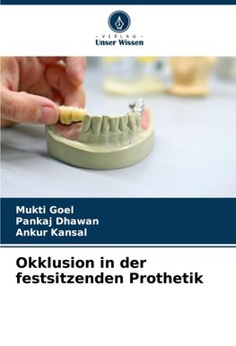 Okklusion in der festsitzenden Prothetik