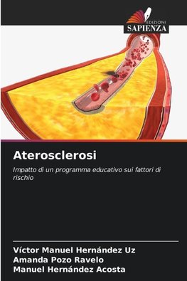 Aterosclerosi