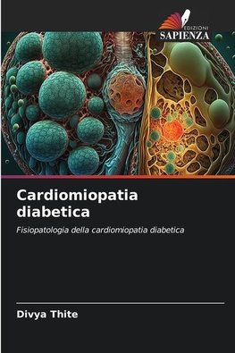 Cardiomiopatia diabetica