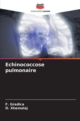 Echinococcose pulmonaire