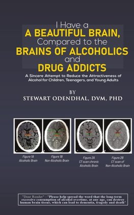 I Have a Beautiful Brain, Compared to the Brains of Alcoholics and Drug Addicts