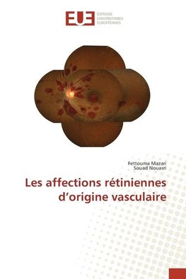 Les affections rétiniennes d'origine vasculaire