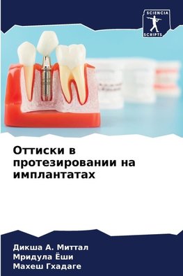 Ottiski w protezirowanii na implantatah