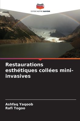 Restaurations esthétiques collées mini-invasives