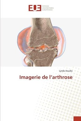 Imagerie de l'arthrose