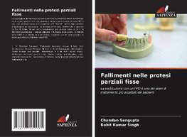 Fallimenti nelle protesi parziali fisse