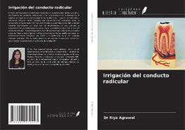 Irrigación del conducto radicular
