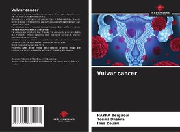Vulvar cancer