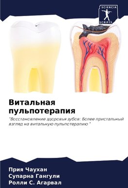 Vital'naq pul'poterapiq