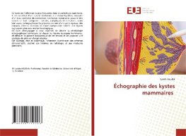 Échographie des kystes mammaires