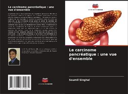 Le carcinome pancréatique : une vue d'ensemble