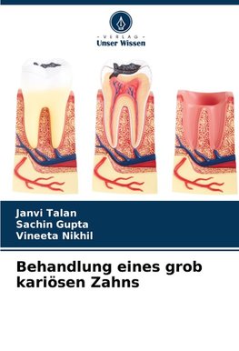 Behandlung eines grob kariösen Zahns